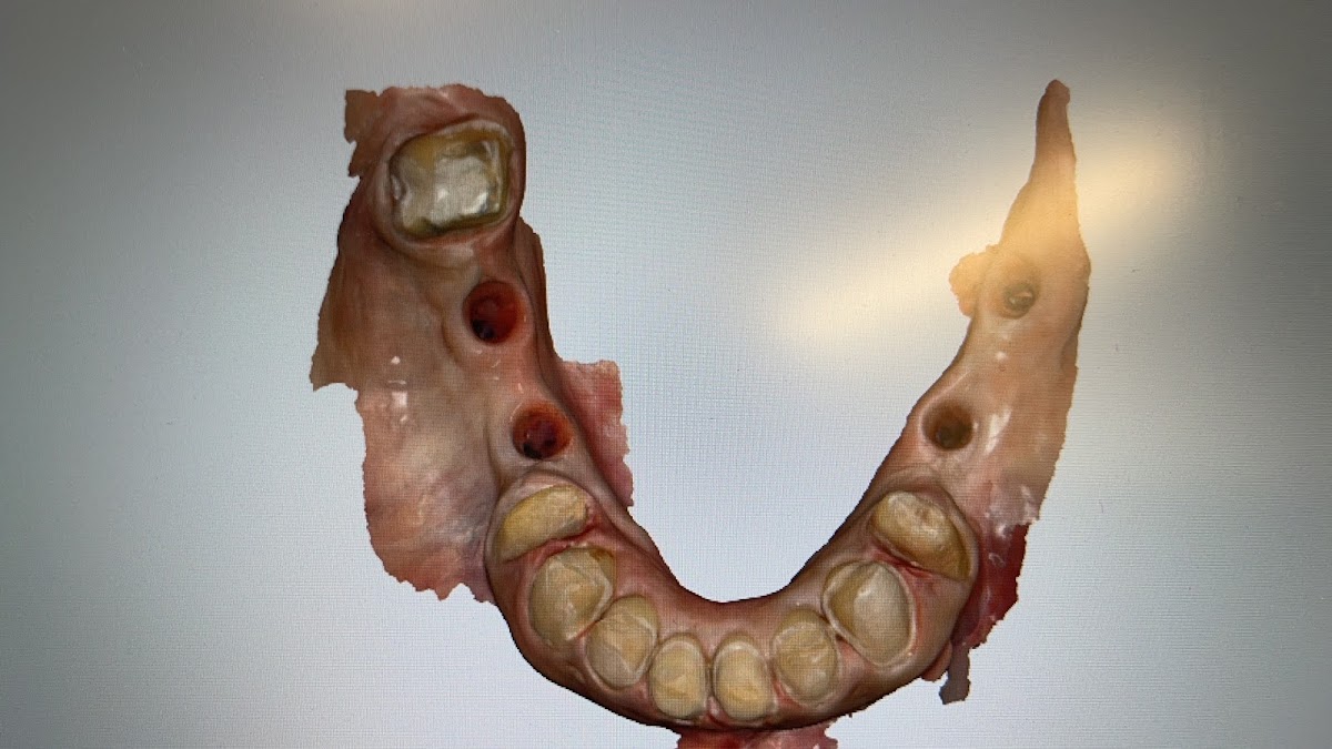 Myrtle Grove Implant and Family Dentistry photo 3