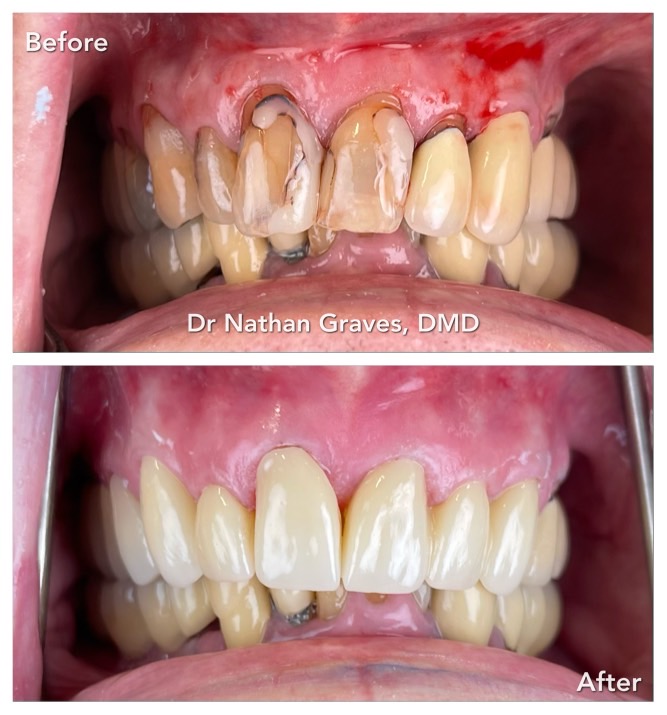 Myrtle Grove Implant and Family Dentistry photo 5