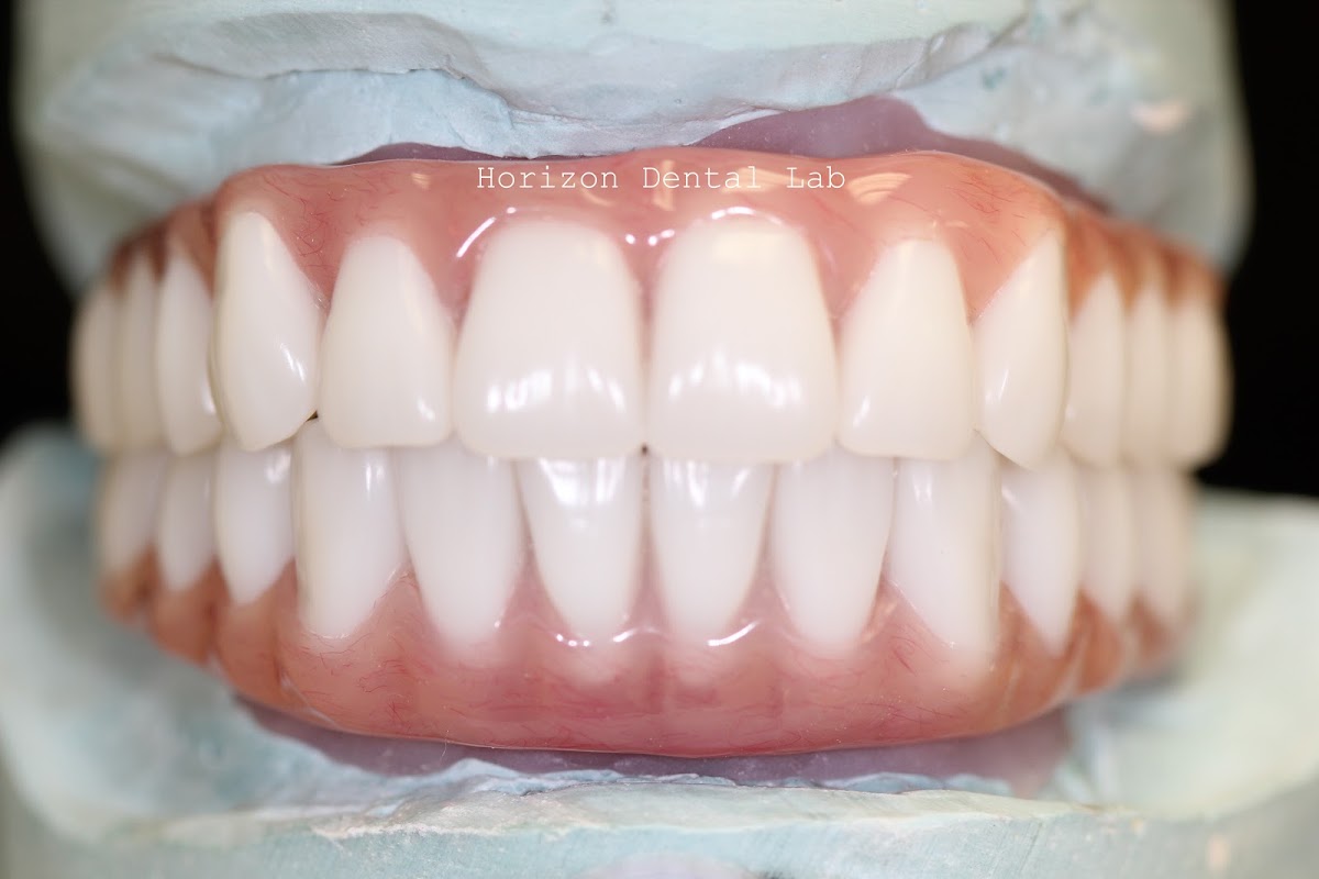 Horizon Dental Lab photo 1