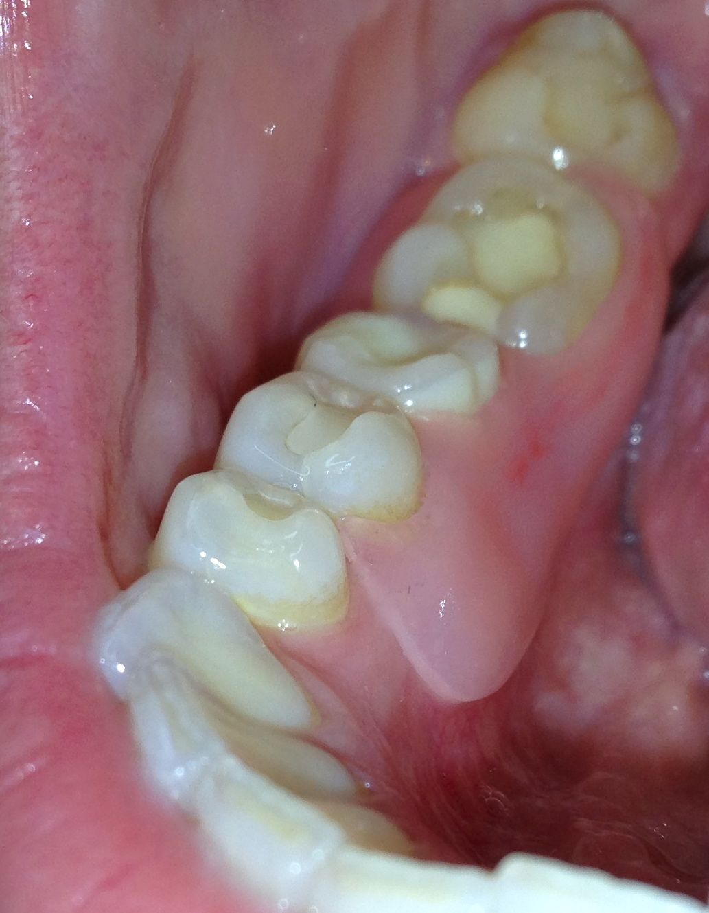 Horizon Dental Lab photo 4