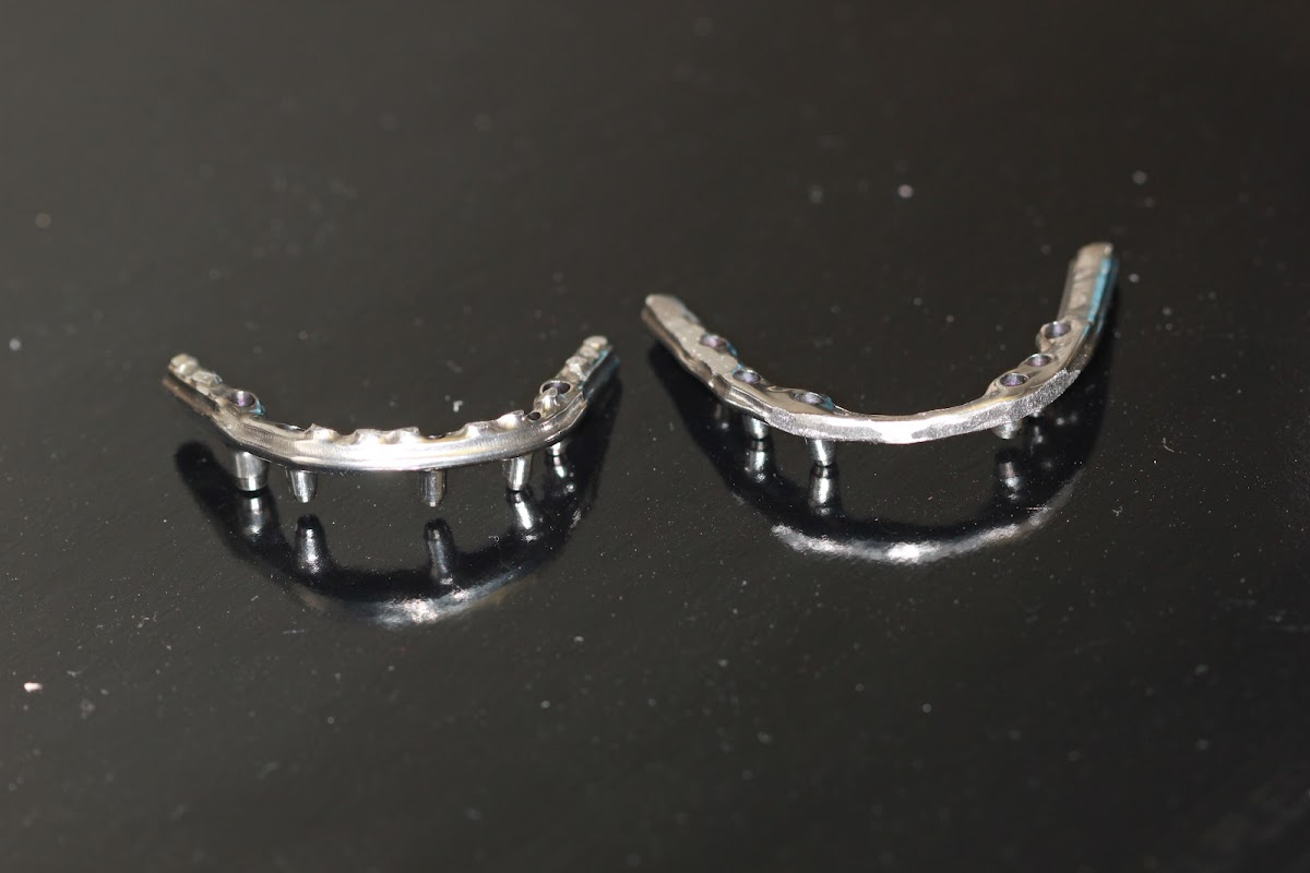 Horizon Dental Lab photo 5