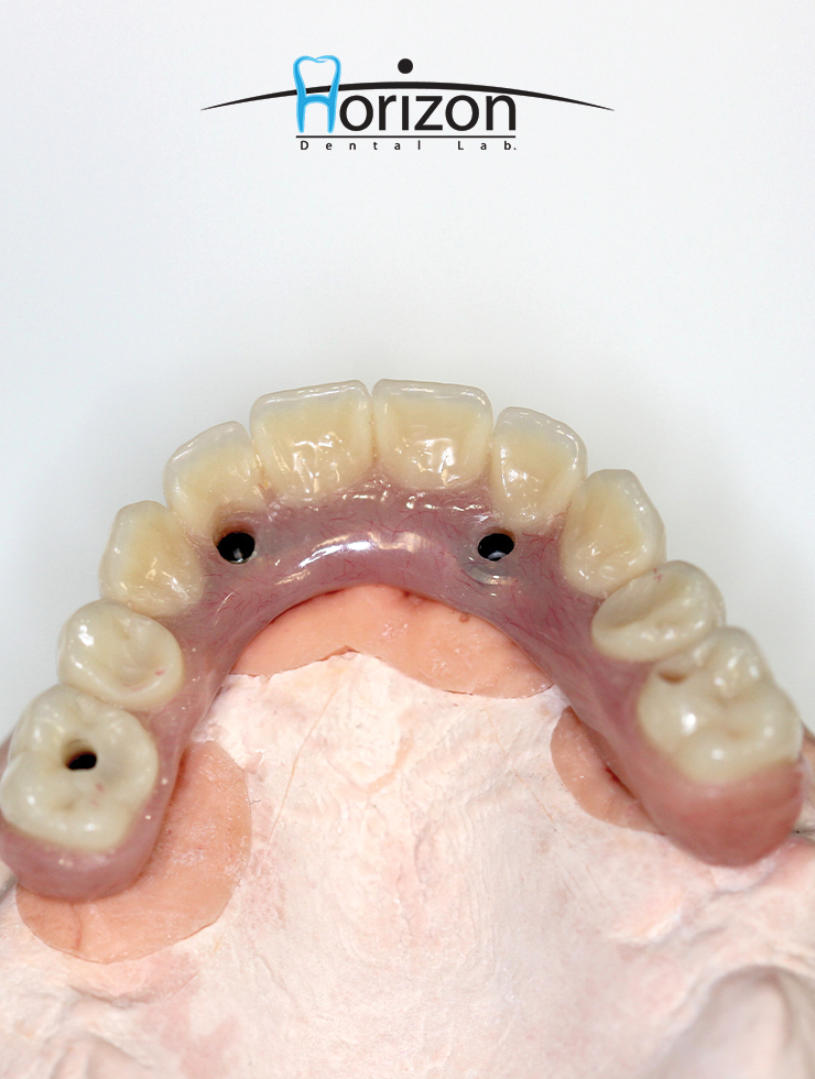Horizon Dental Lab photo 6