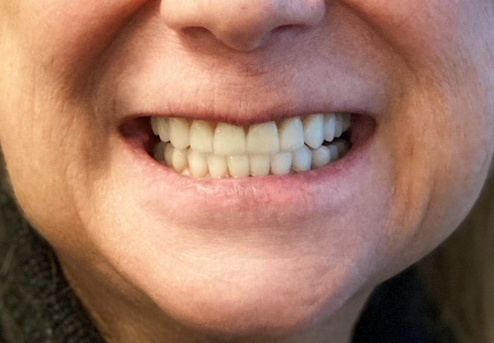 Ridgetop Dental Implants photo 6