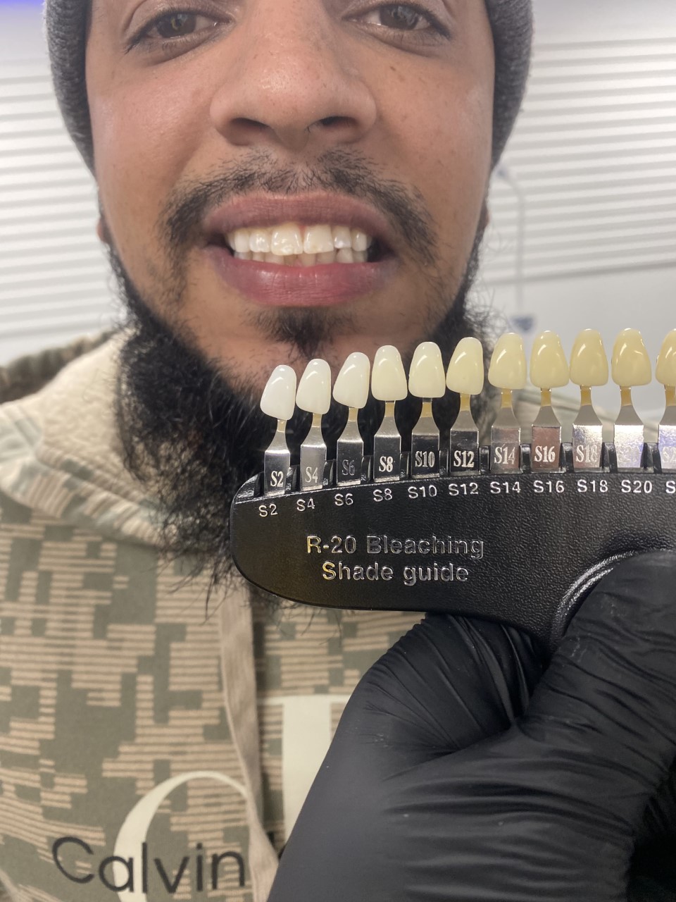 Exclusive Micro Scalp & Teeth Whitening photo 6