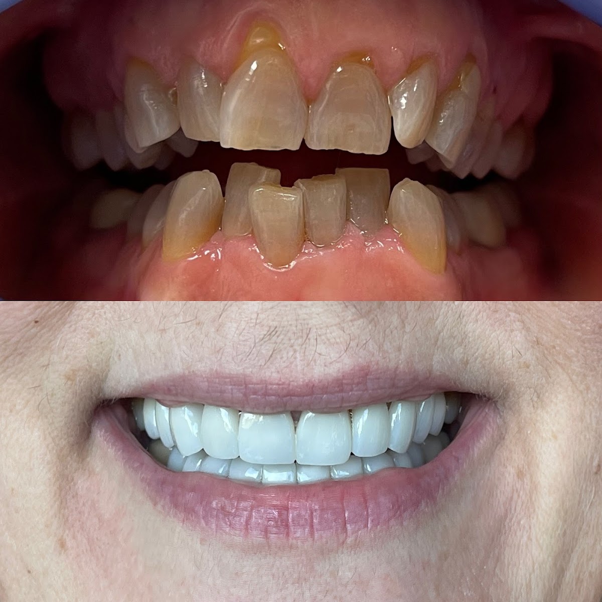 Buffalo General Dentistry | Implant, Sedation & Cosmetic photo 2