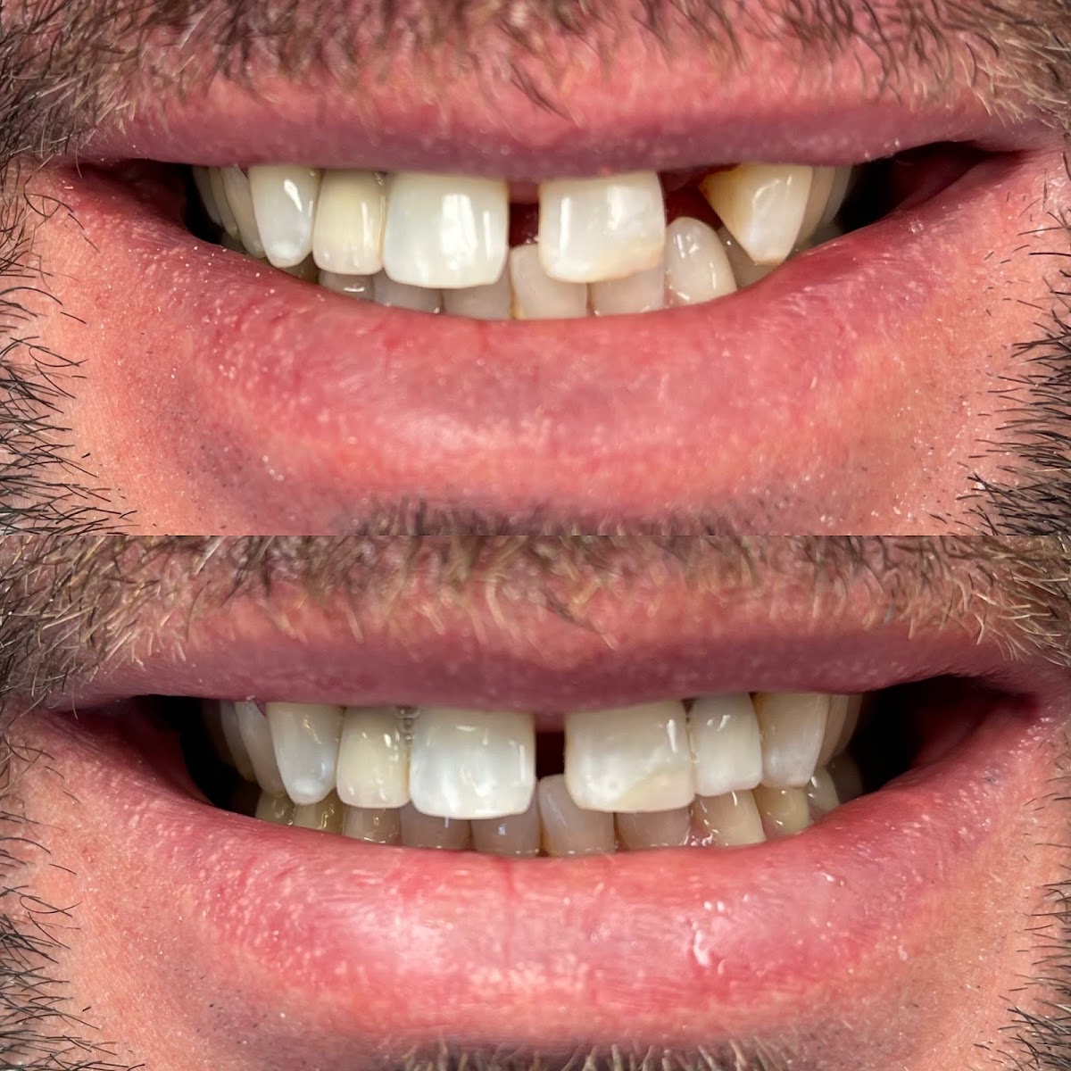 Buffalo General Dentistry | Implant, Sedation & Cosmetic photo 3