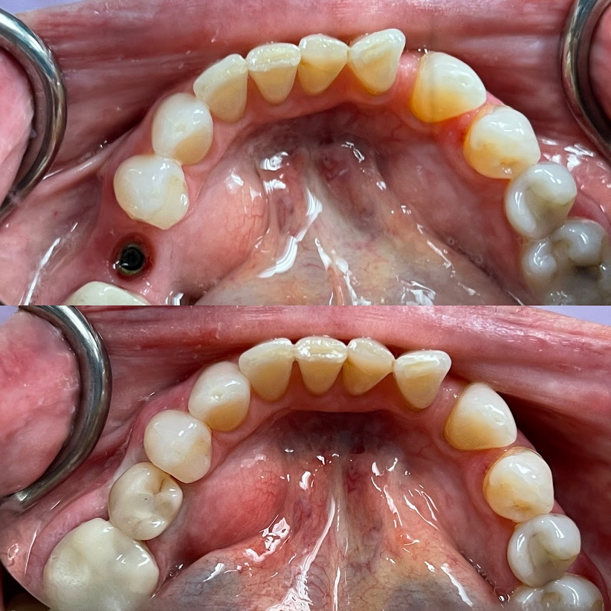 Buffalo General Dentistry | Implant, Sedation & Cosmetic photo 4