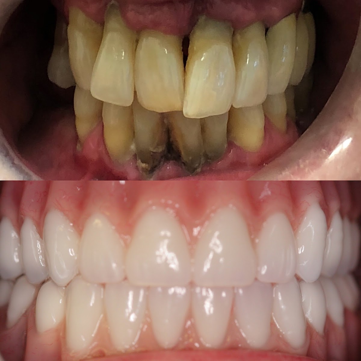 4m Dental Implant Center - Las Vegas photo 2