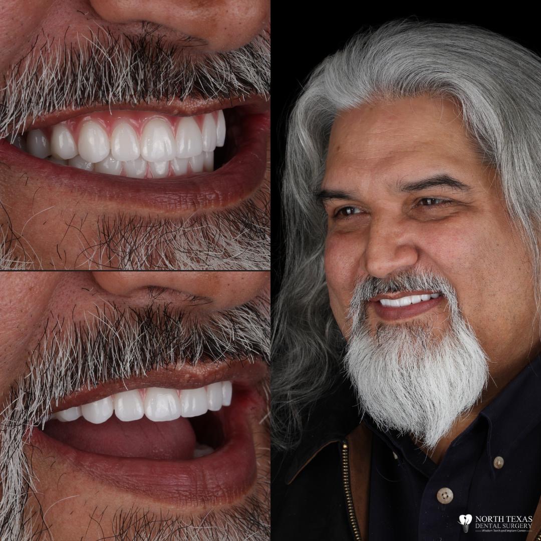 North Texas Dental Surgery Wisdom Teeth And Denture Implant Center photo 1