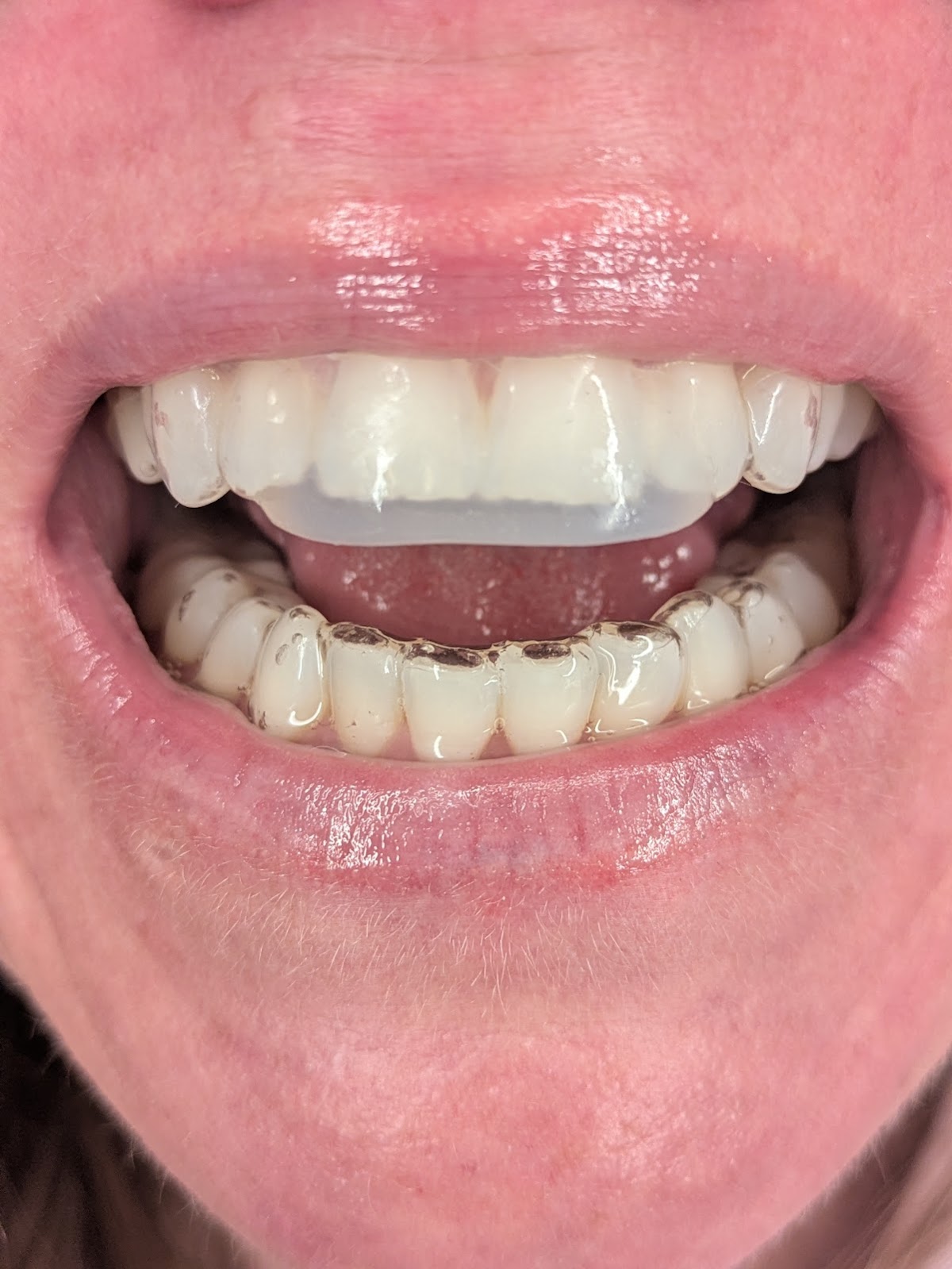 Blue Ridge Family Dentistry PC photo 3
