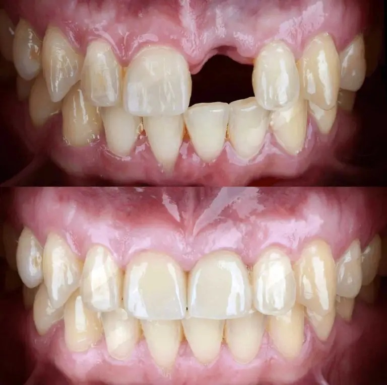 Wellspring Family Dental & Implant Center - Dr. David Butts photo 3