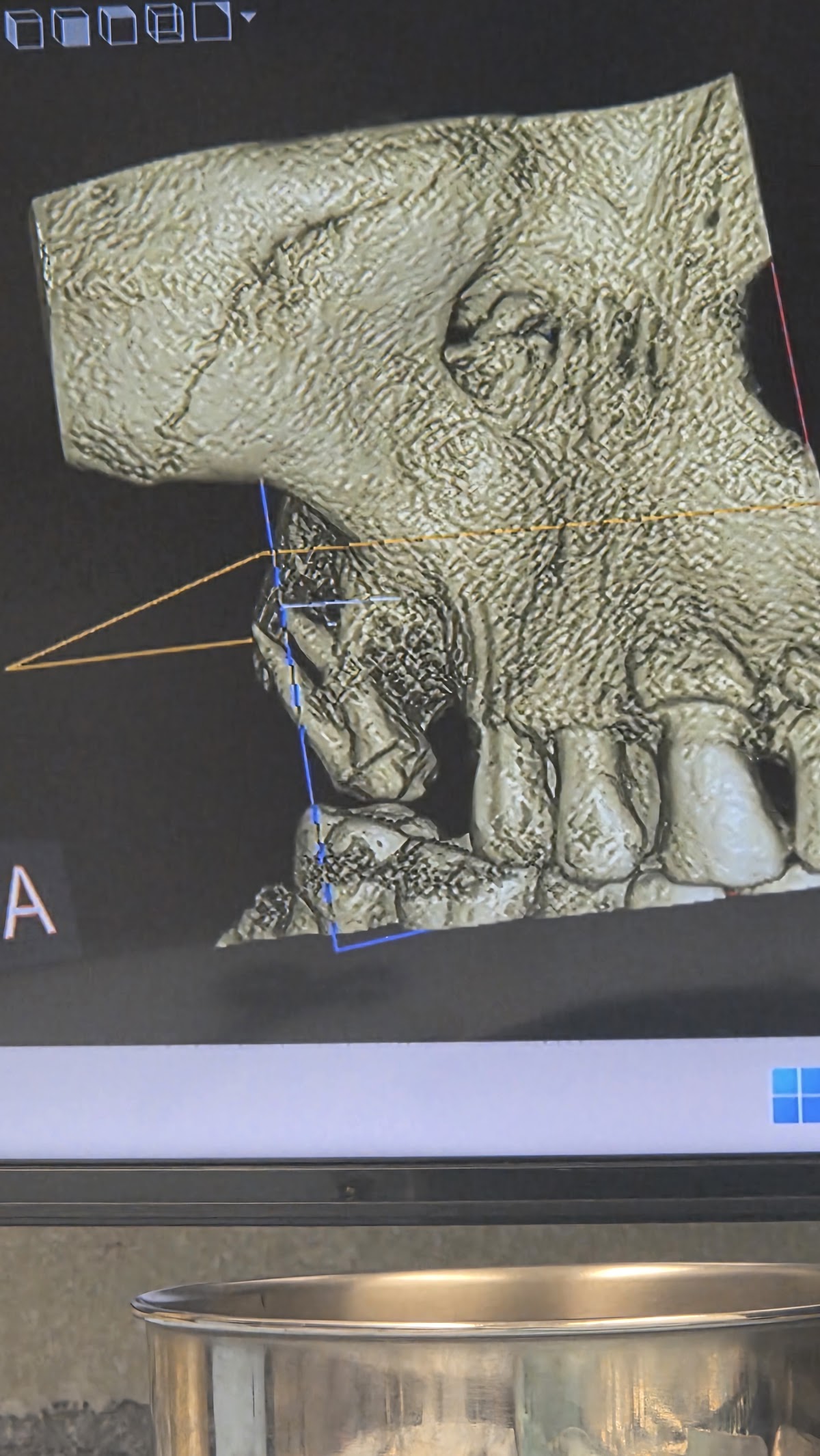 Roanoke Oral Surgery Inc photo 5