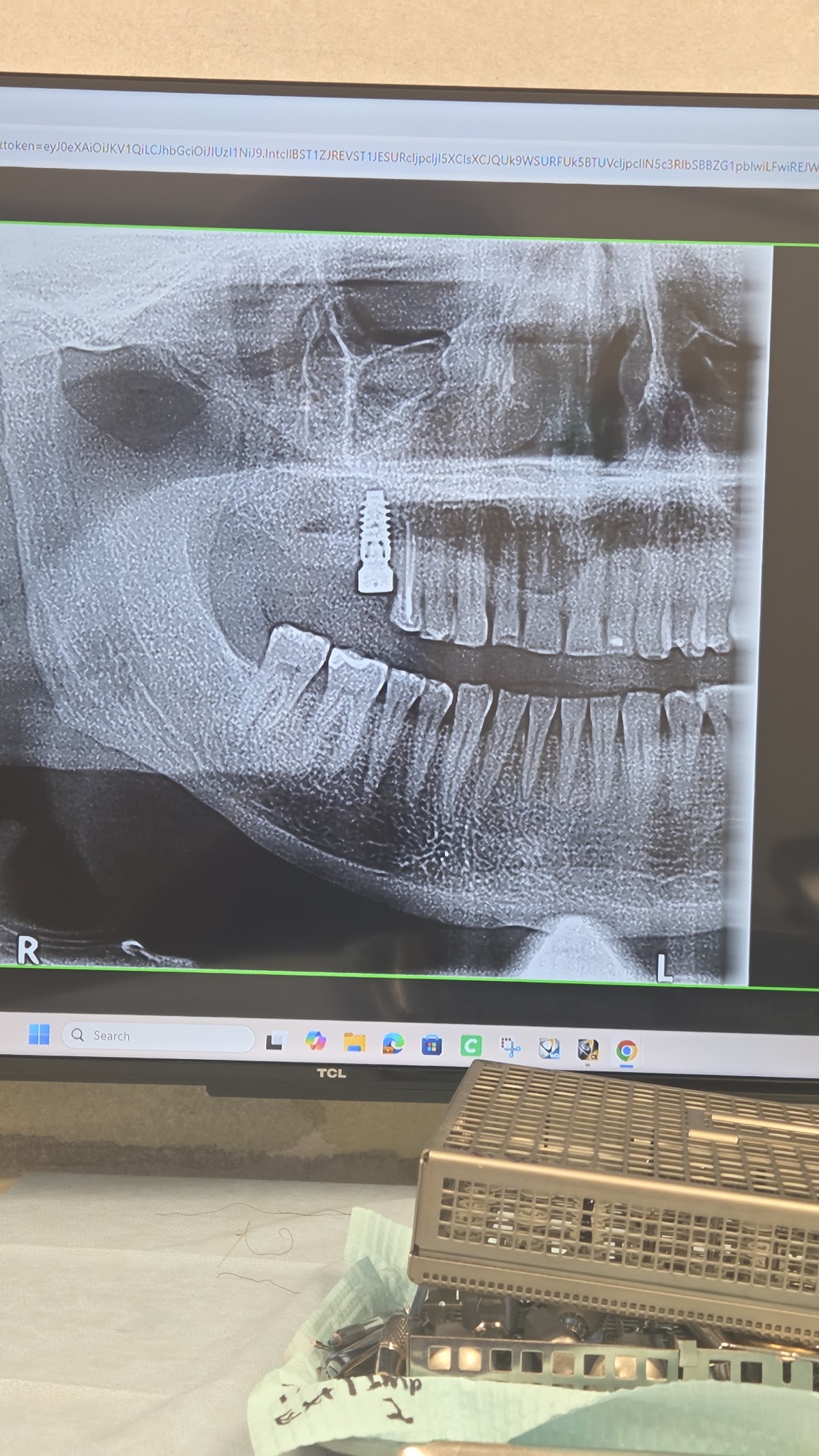 Roanoke Oral Surgery Inc photo 6