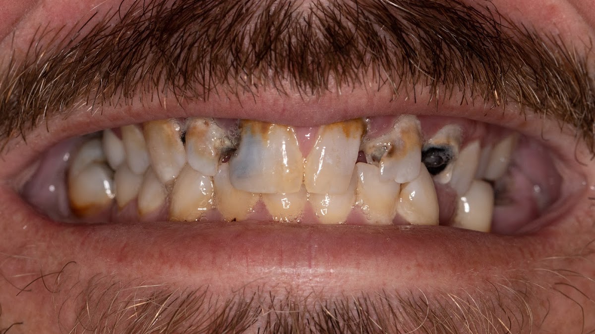 Huntline Dental Group photo 5