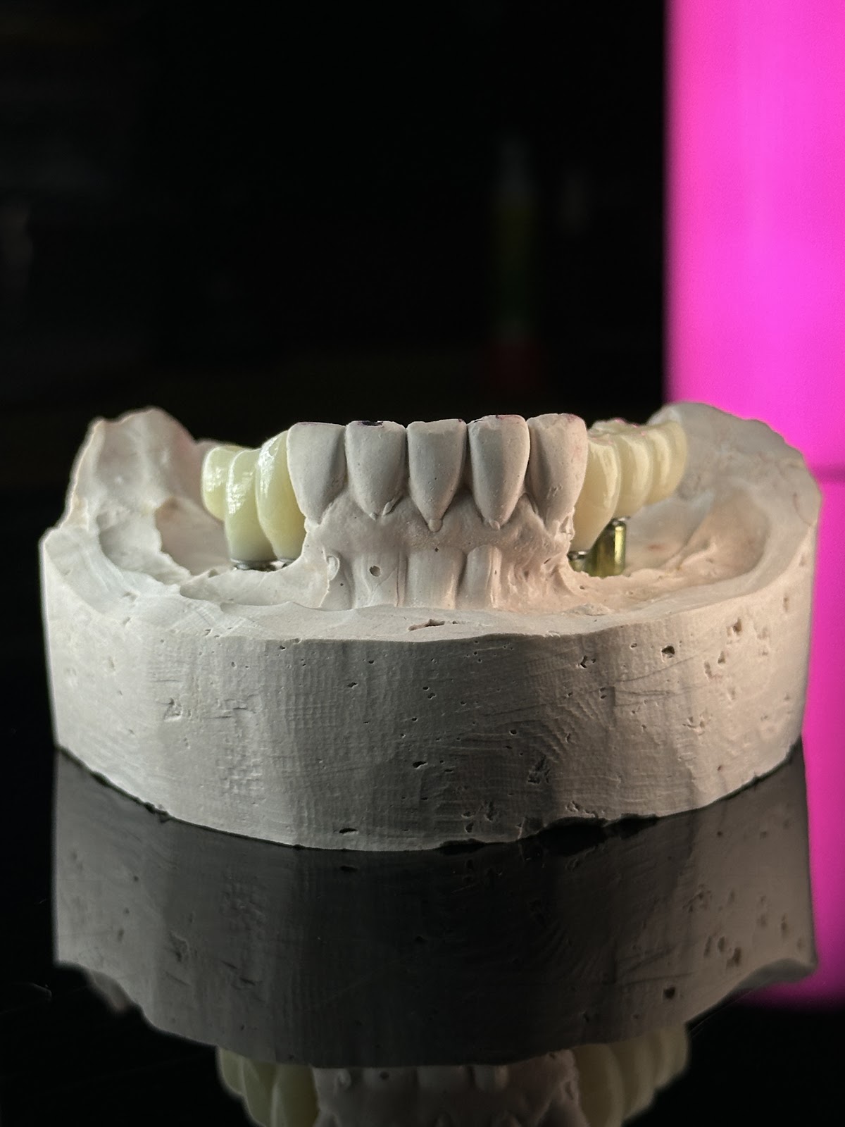 Vertex Dental Studio LLC photo 3
