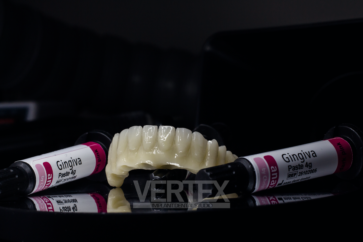 Vertex Dental Studio LLC photo 4