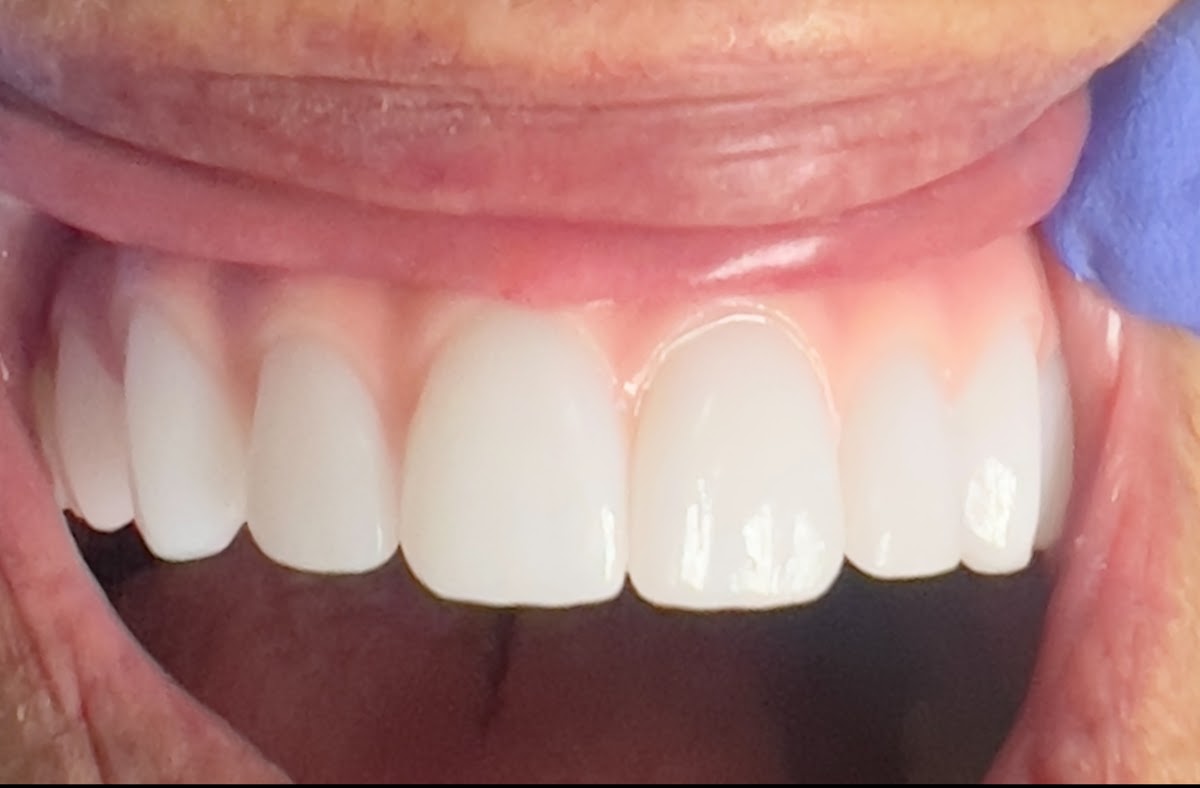 Vertex Dental Studio LLC photo 5
