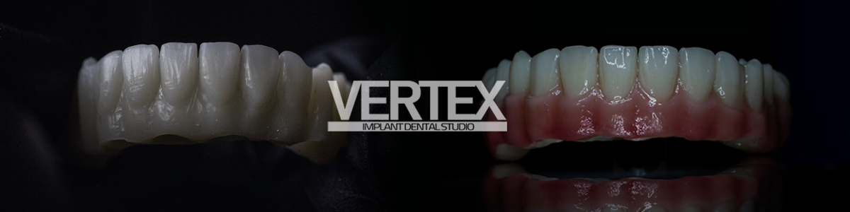 Vertex Dental Studio LLC photo 6