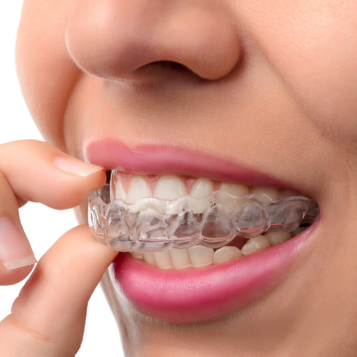 Bellevue Dental Care & Implant Center photo 3