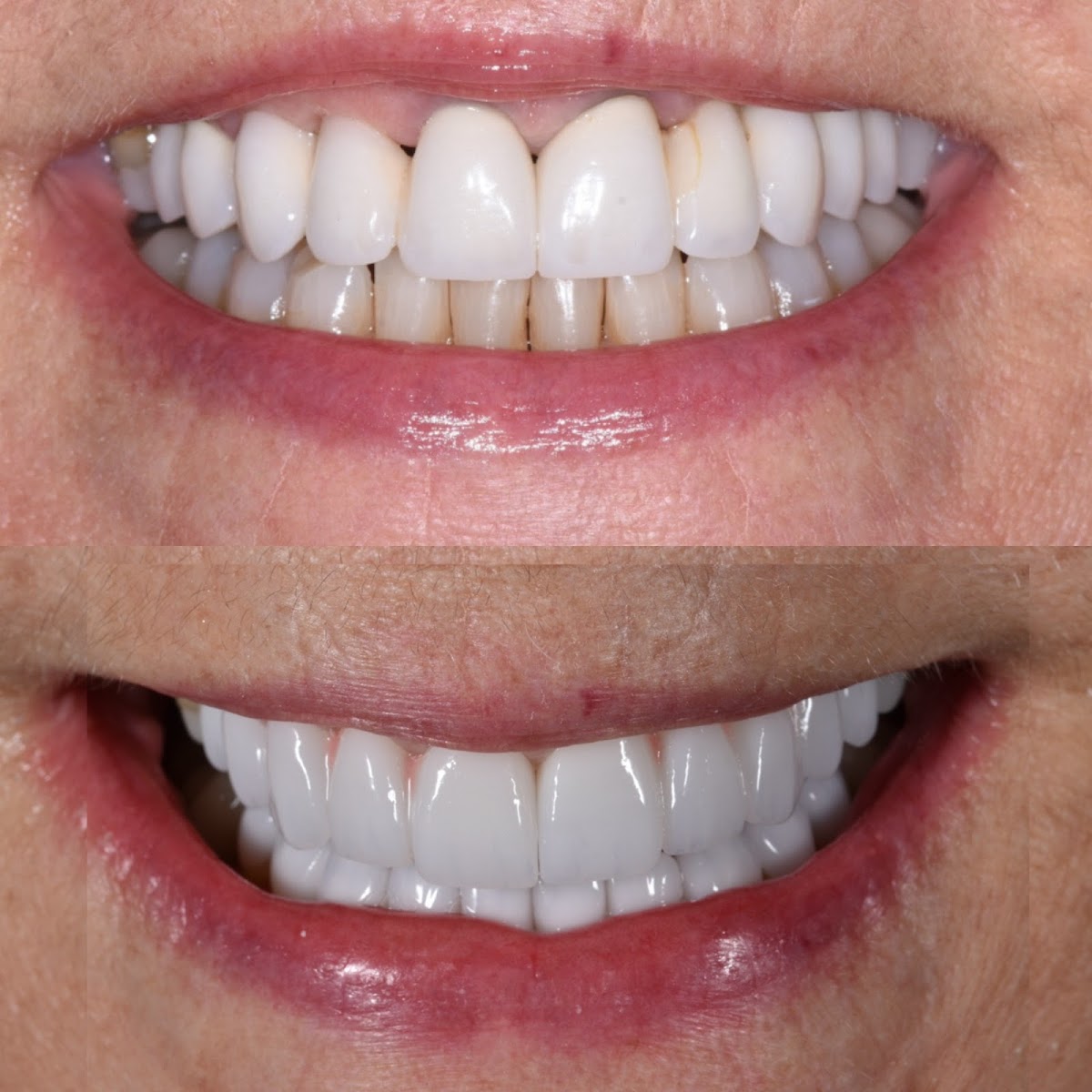 Beverly Hills Dentistry photo 1