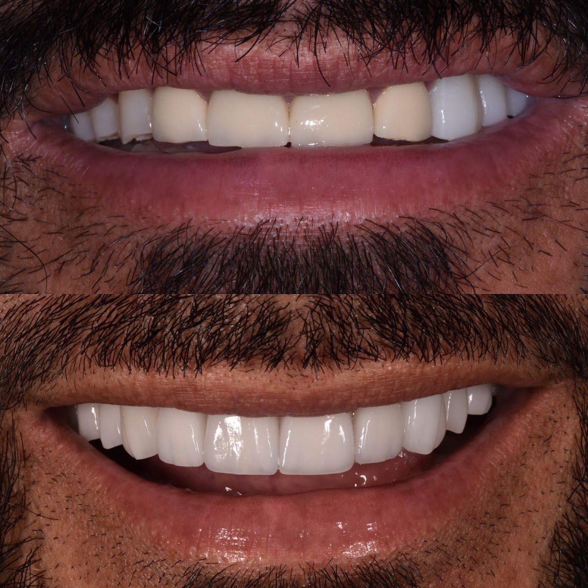 Beverly Hills Dentistry photo 5