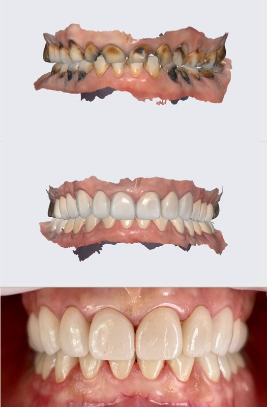 Northpointe Dental & Implant Center photo 2