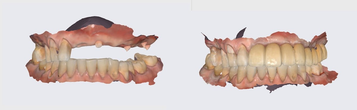 Northpointe Dental & Implant Center photo 5