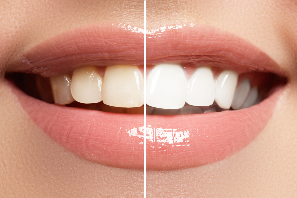 Maiden Lane Dental - Financial District Nyc photo 3