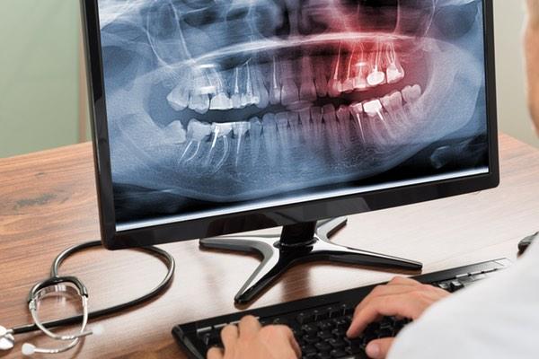 Maiden Lane Dental - Financial District Nyc photo 4