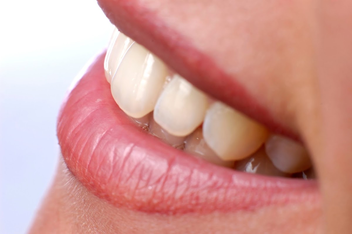 Meridian Dental photo 3