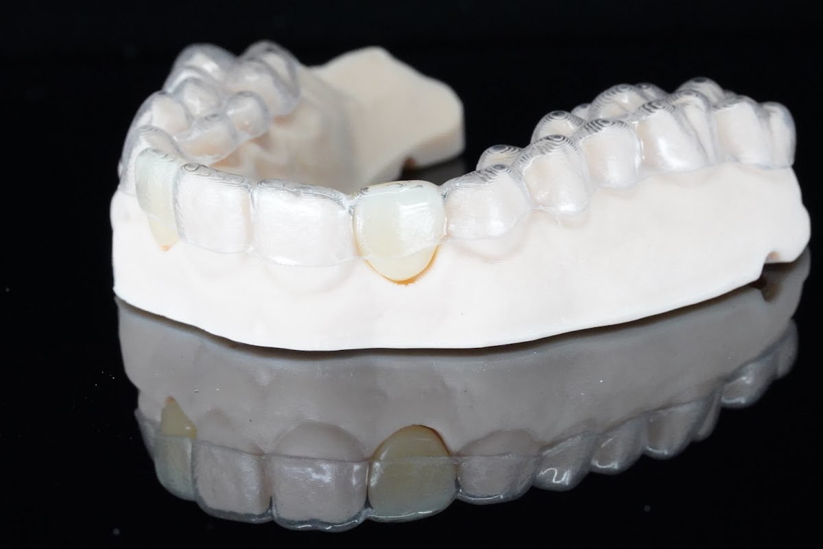 Black Hills Dentures & Implants photo 6