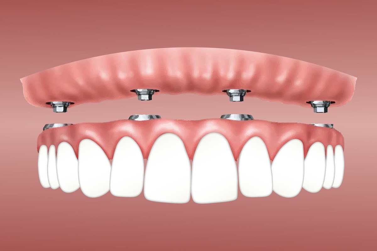 Trevisani Oral Surgery & Dental Implants photo 2