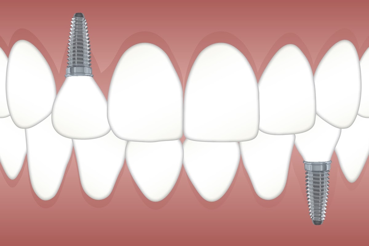 Trevisani Oral Surgery & Dental Implants photo 3