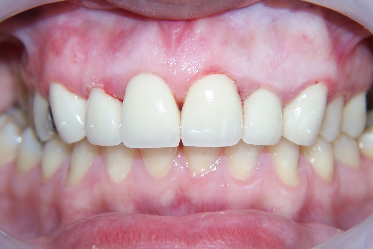Aesthetic Family Dental & Implant Center photo 3