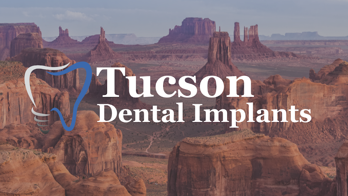 Tucson Dental Implants photo 6