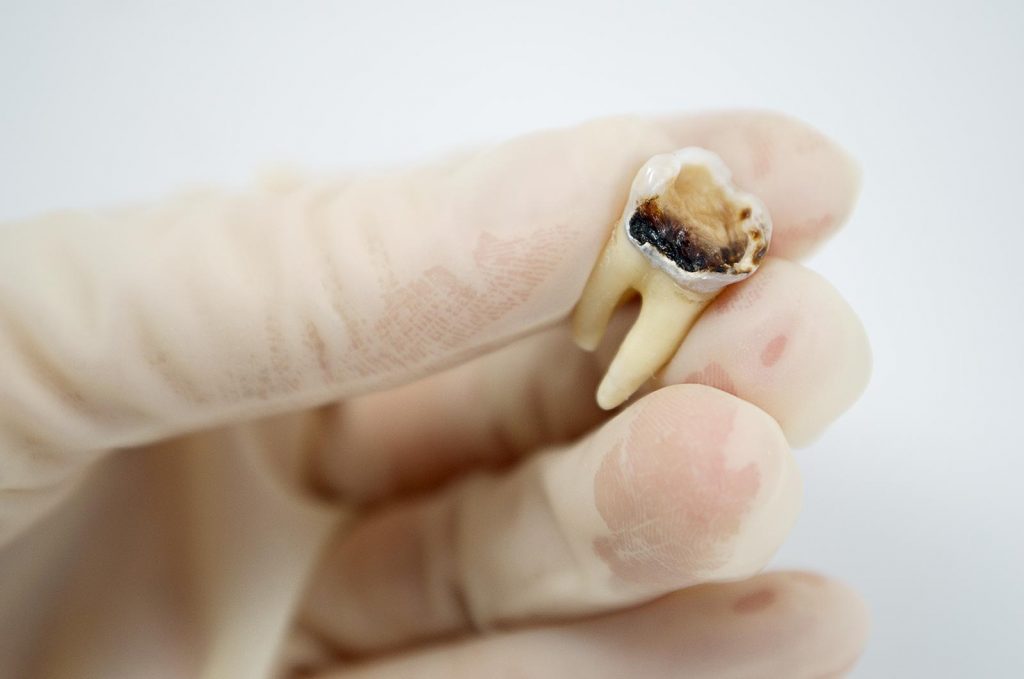 Crescent Family and Cosmetic Dentistry of Columbia photo 2
