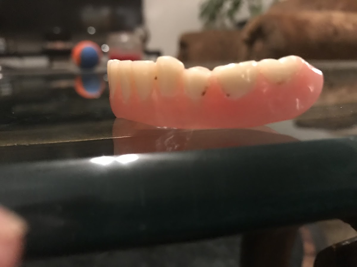 Aspen Dental - Lawton photo 5