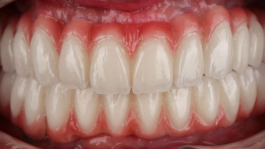 New Life Dental Implant Center photo 1