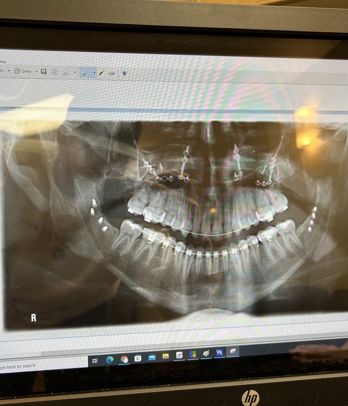 Snake River Surgical - Bryan D Lee DDS, MD and Jordan J Clawson DDS, MD photo 3