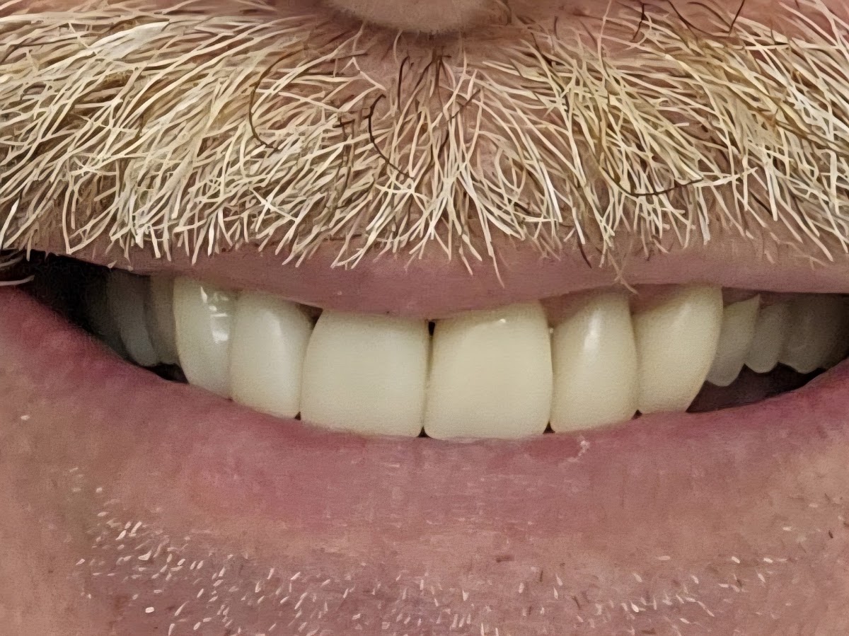 Deland Implant Dentistry photo 3
