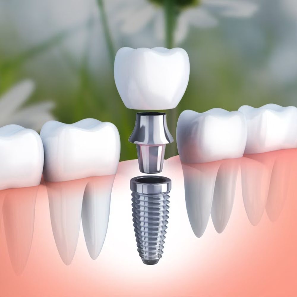 Dr. Jeannie Chung & Dr. Eric Lee - Periodontics & Dental Implants photo 2