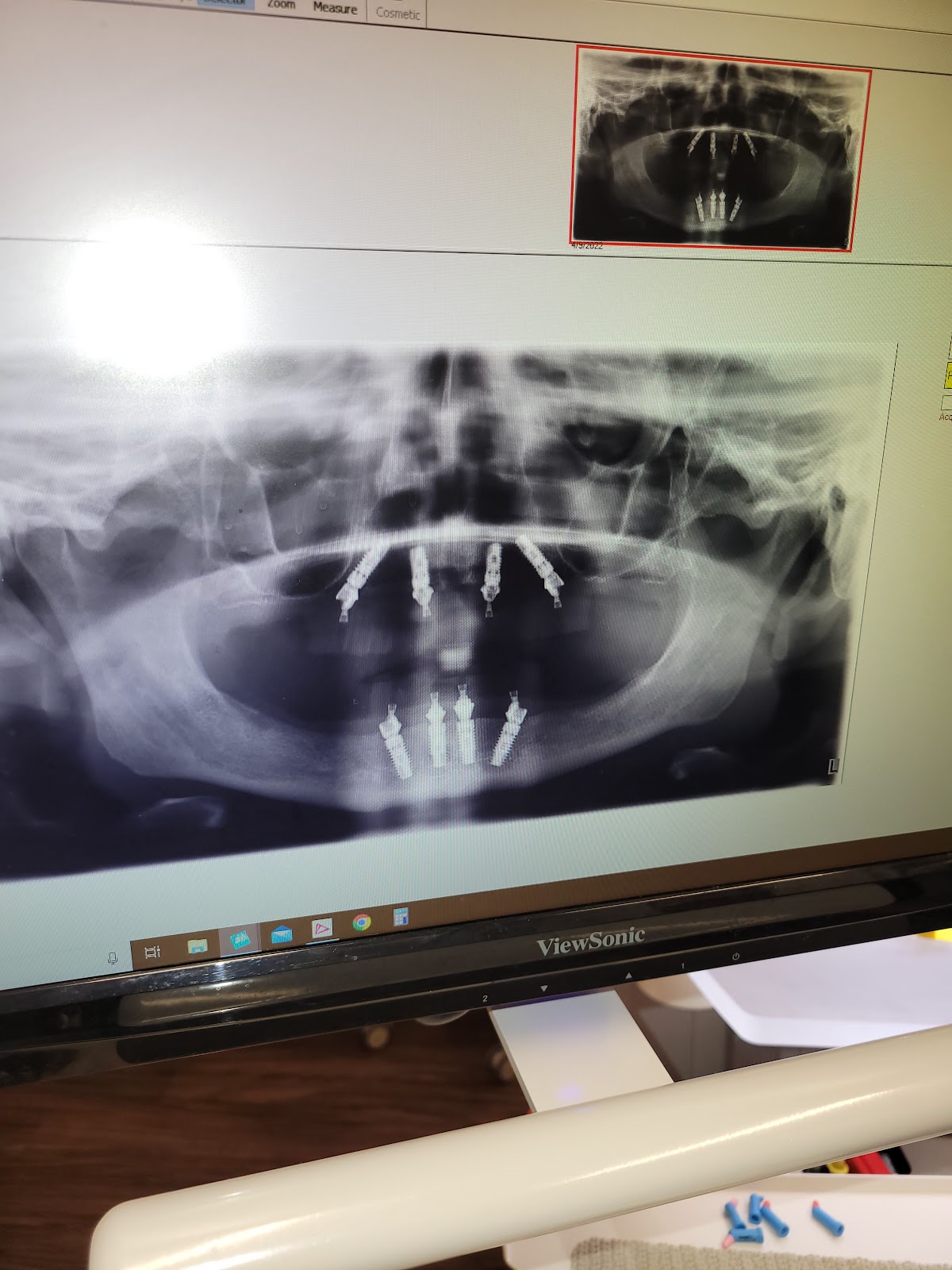 360 Family And Implant Dentistry- Dr. Ticole Nguyen And Dr. Christopher Gonzales photo 1