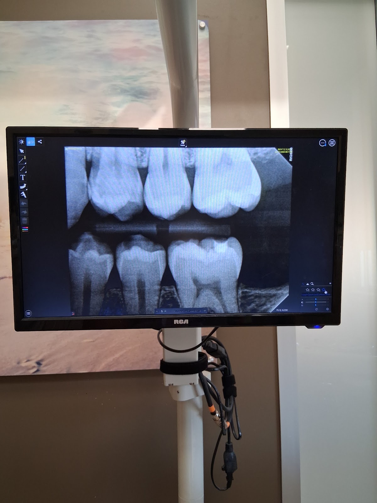 Aspen Dental - West Allis photo 3