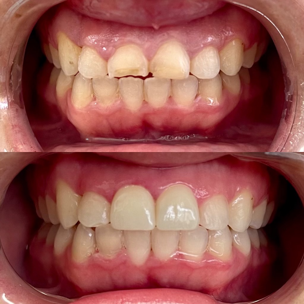 Brilliance Dental Of Anaheim photo 6