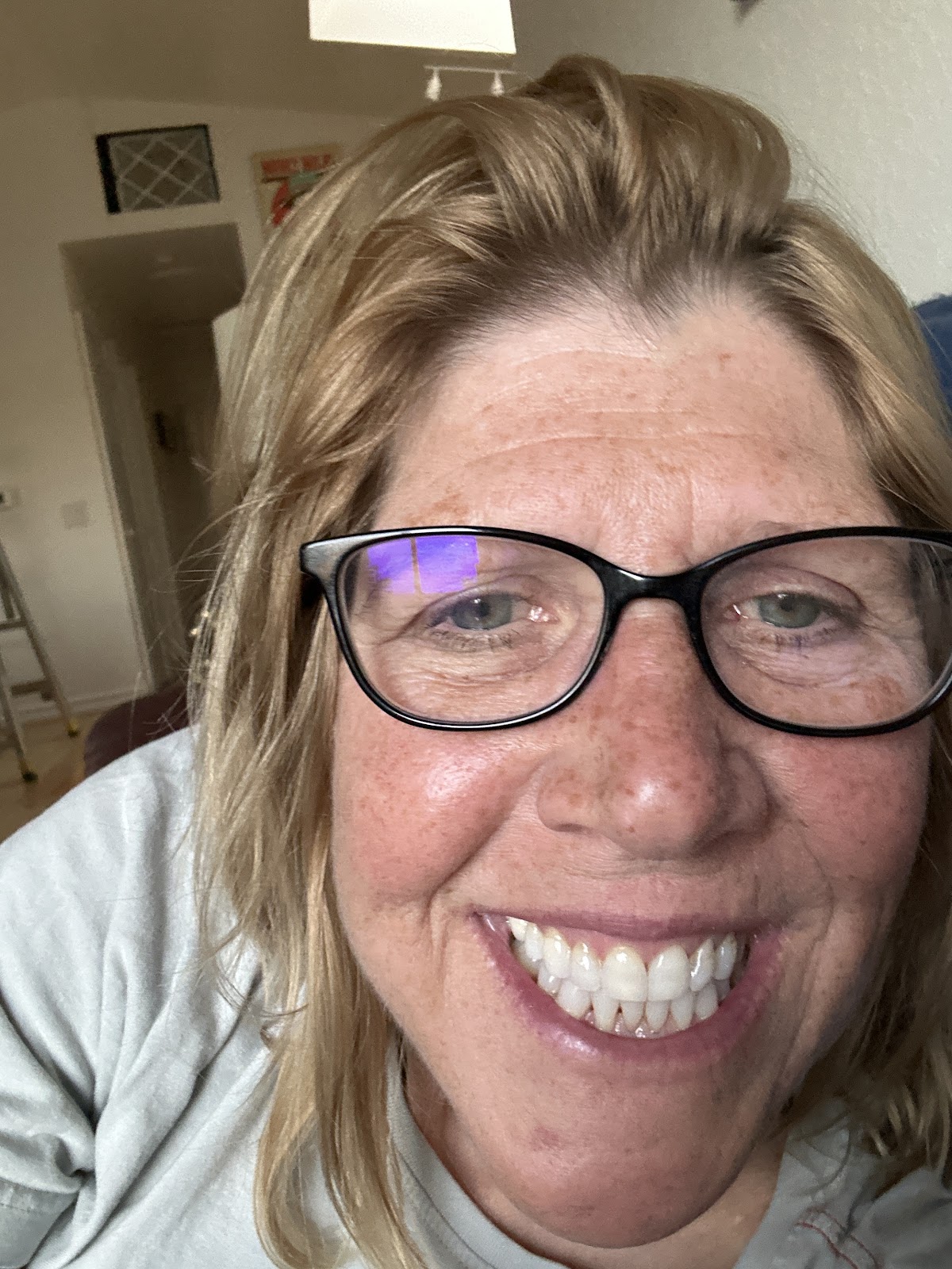 David M. White, DDS - Cosmetic Dentist Elko photo 4