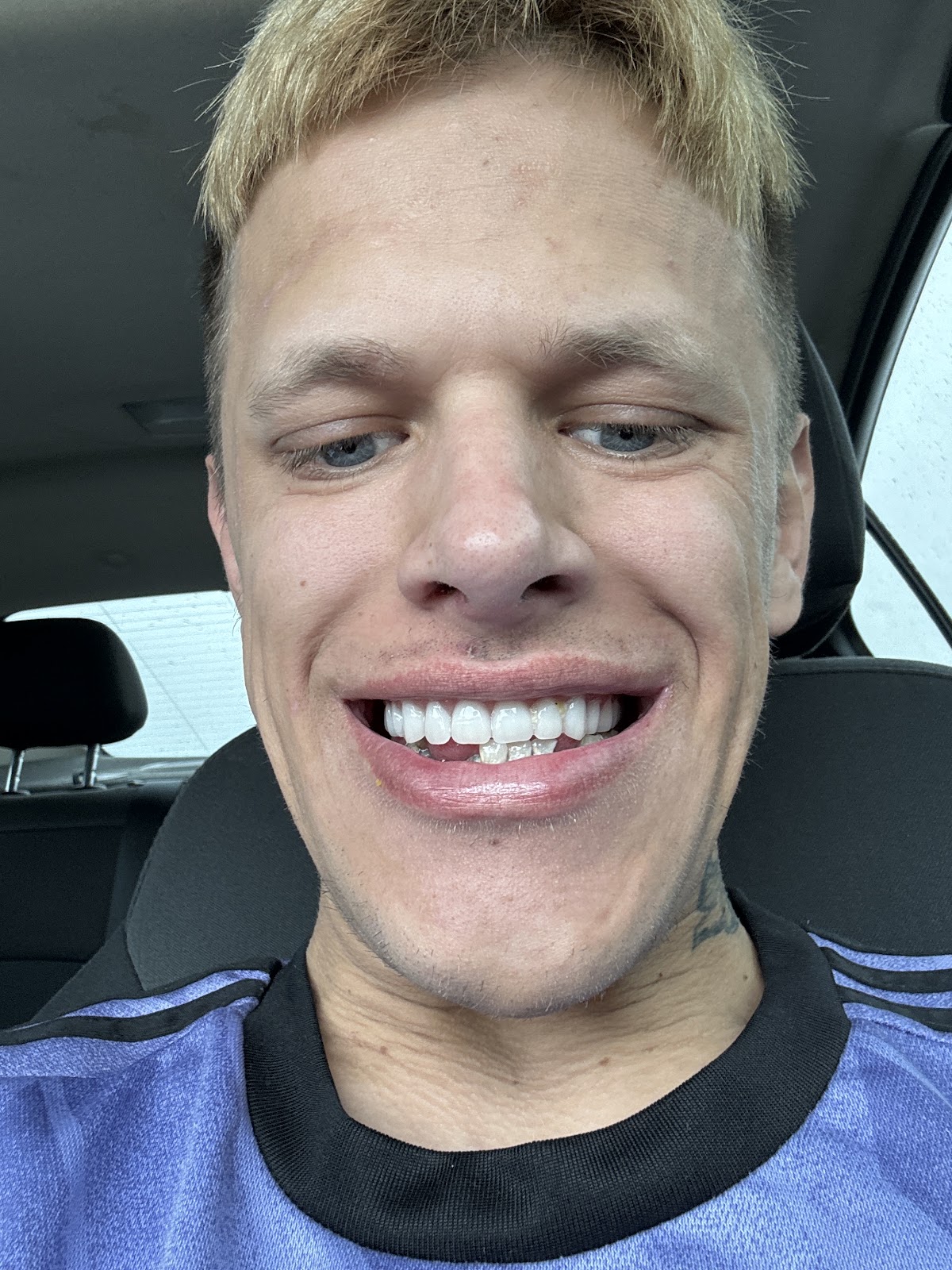 Affordable Dentures & Implants - Lafayette photo 5