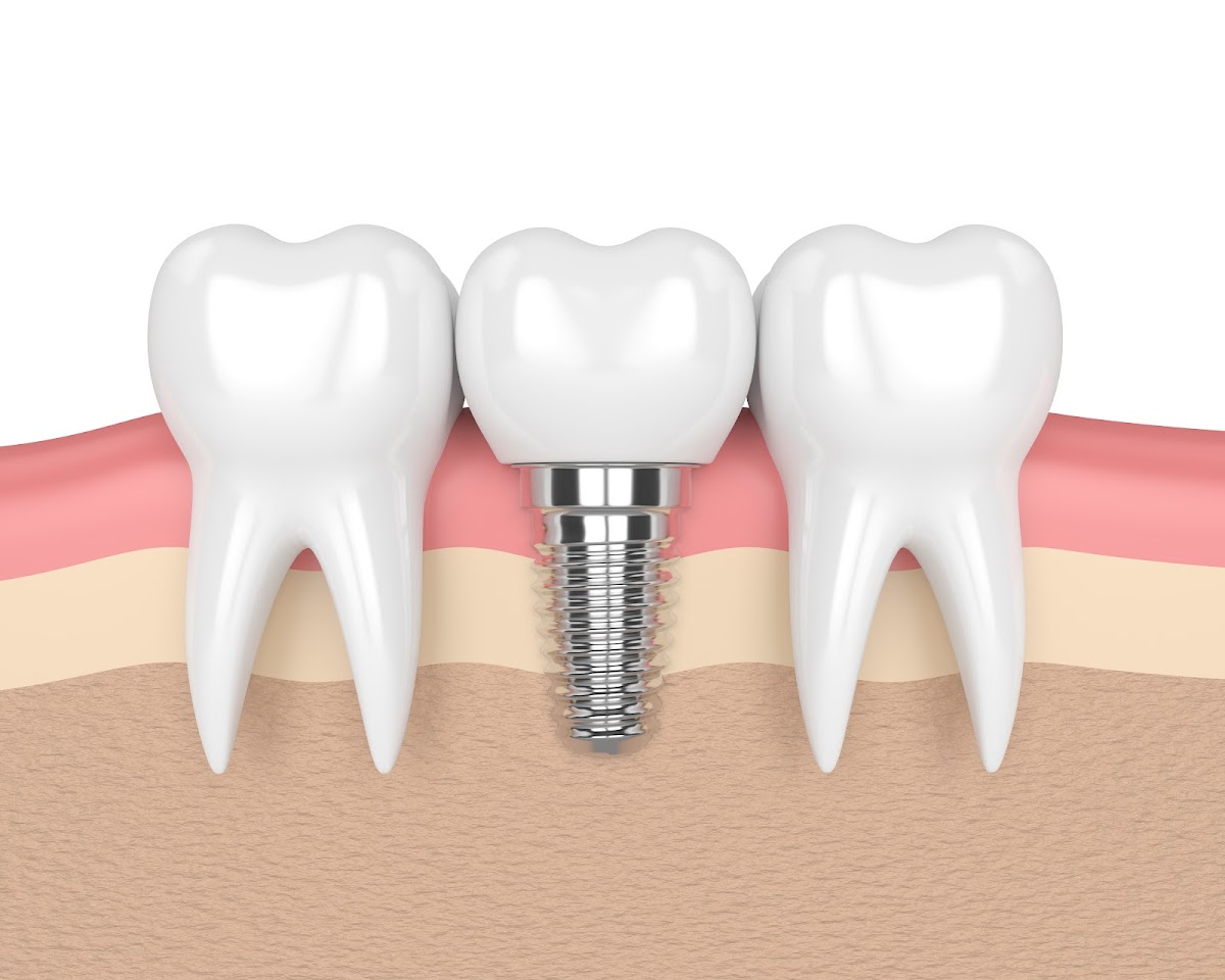 Monterey Coast Periodontics And Implant Dentistry photo 5