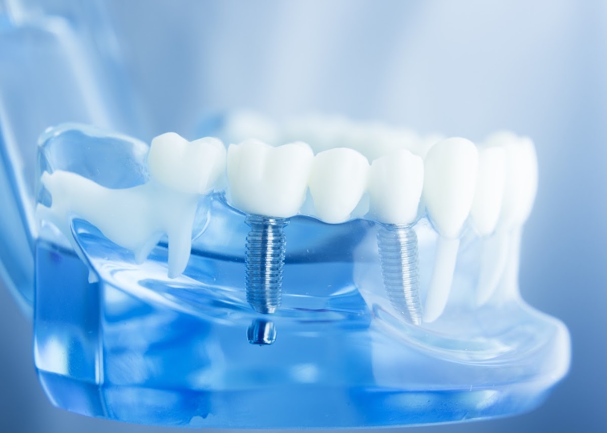 Monterey Coast Periodontics & Implant Dentistry (Carmel Location) photo 1