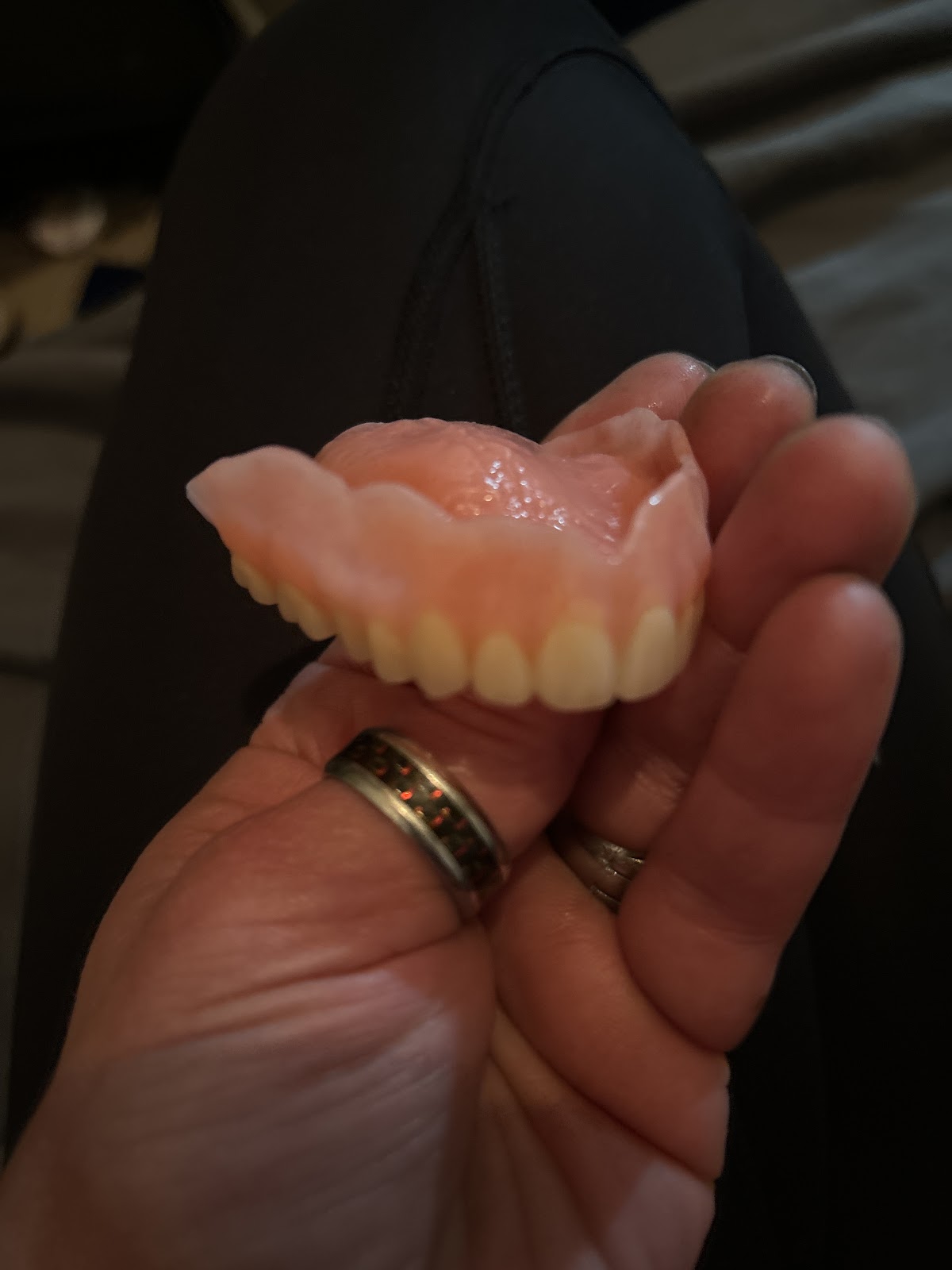 Aspen Dental - Omaha photo 2