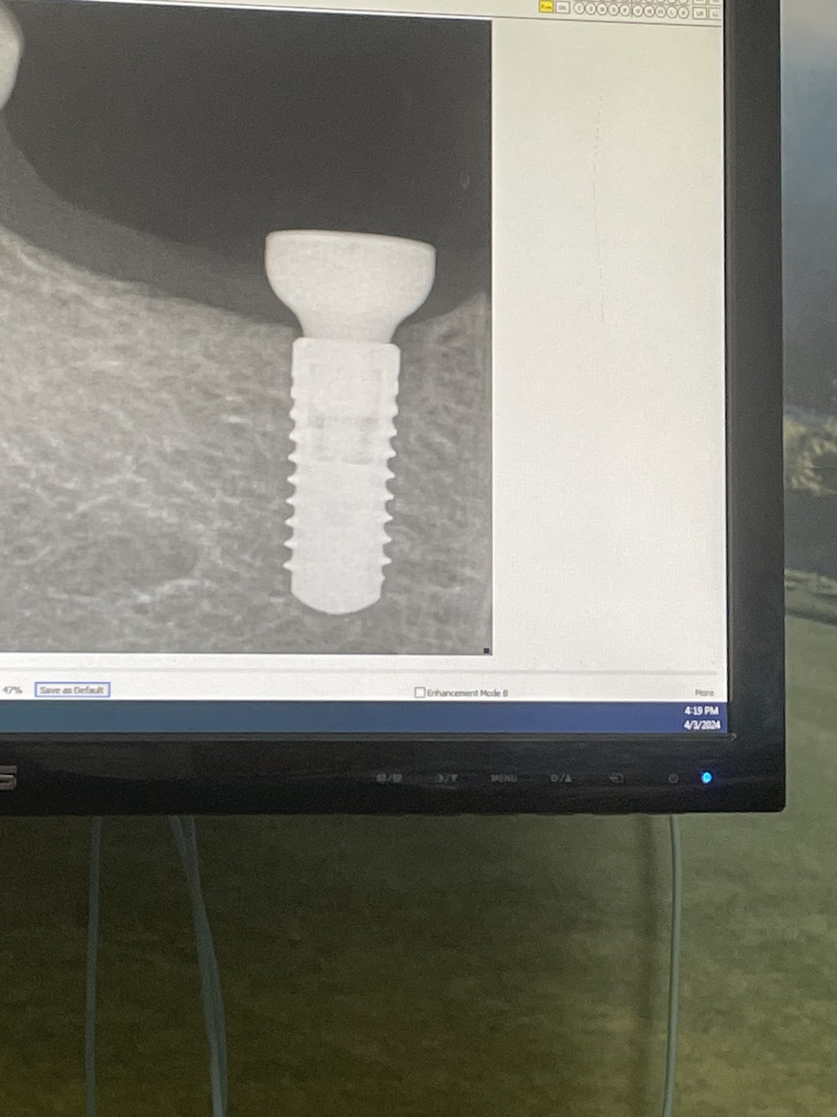 Cny Periodontics and Implants photo 5